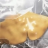 ［双语字幕］医学3D动画 非酒精性脂肪肝的进展：从健康肝脏到肝硬化