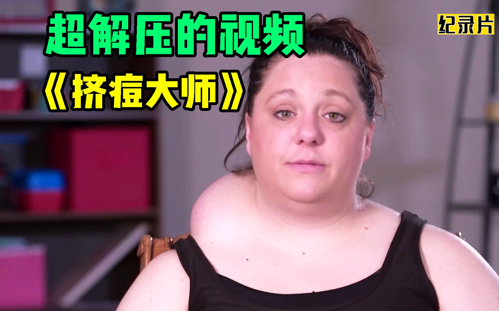 美女后颈部上出现肿块,李医生帮她给切除掉,过程极度解压舒适!哔哩哔哩bilibili