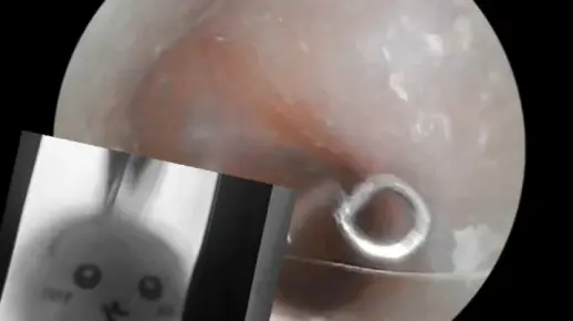 【可视采耳.海底捞刮耳膜.铲耳皮.轻语助眠】长视频来啦(*´I`*)