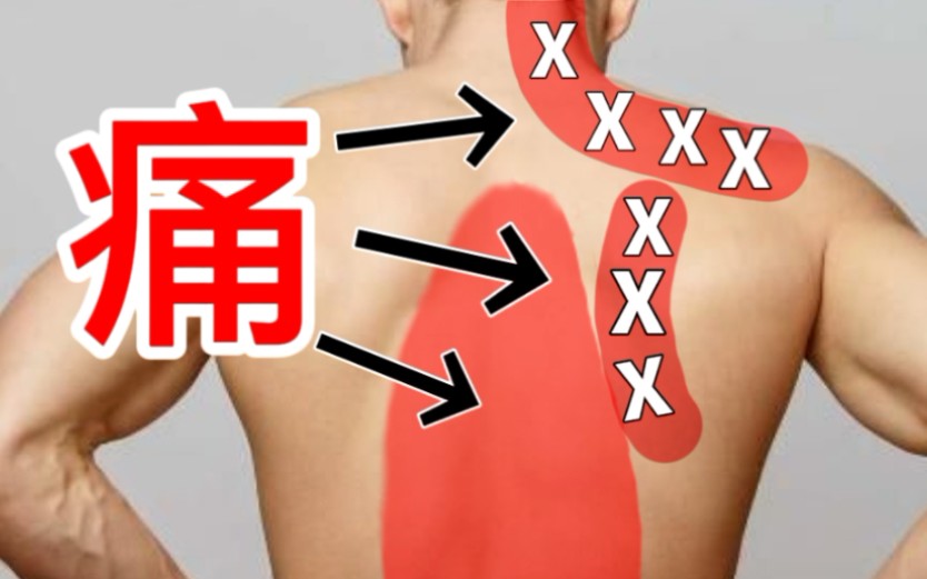 右肩后背疼痛是什么原因