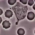 自然免疫力-白细胞吞噬细菌的过程