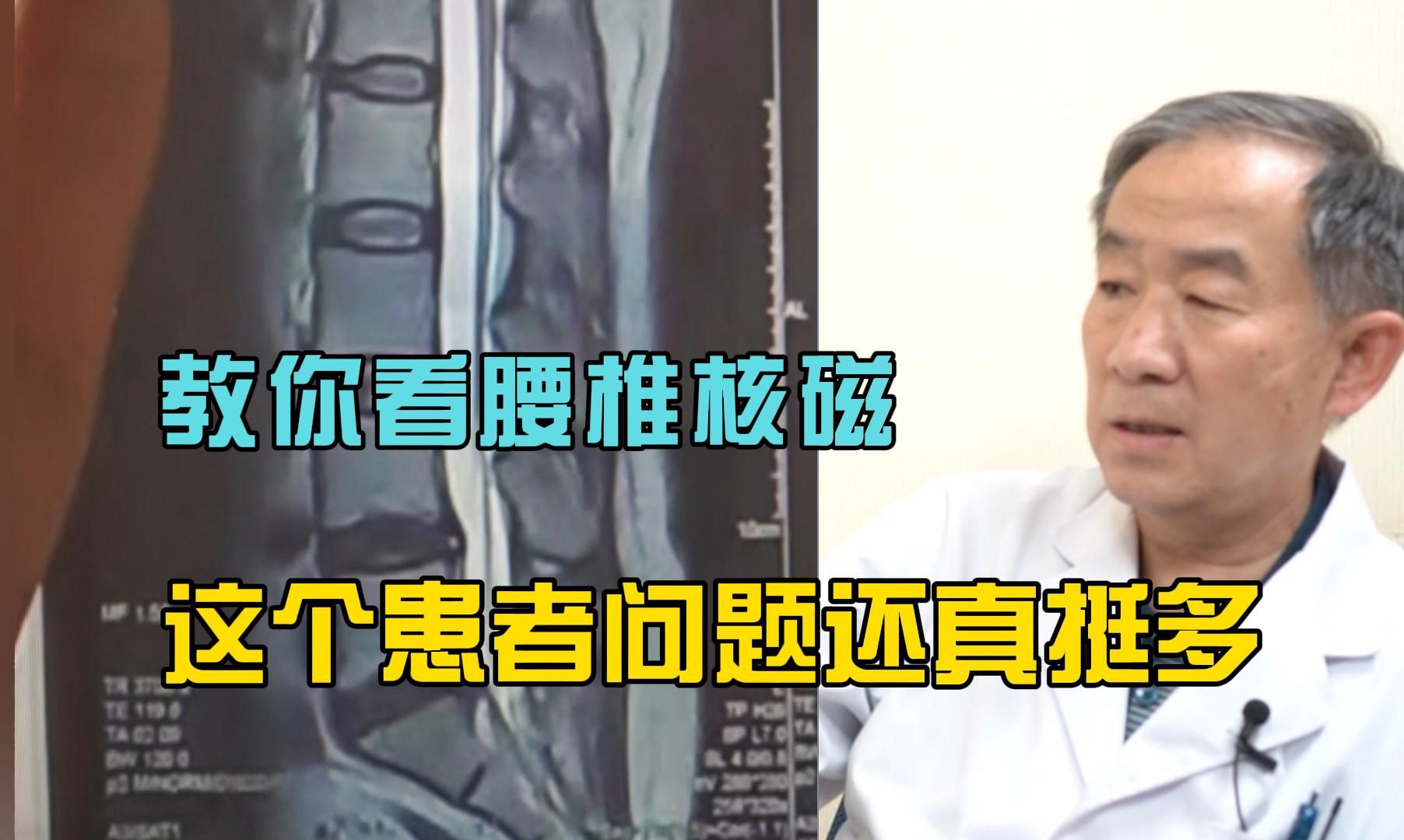 骨科蔡军主任，教你看腰椎核磁，这个患者问题还真挺多