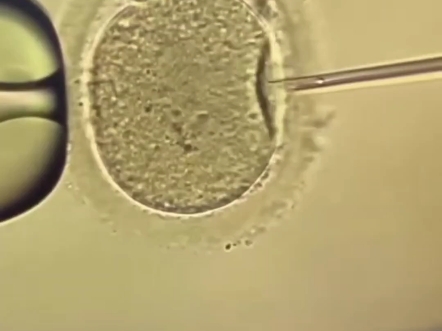 卵胞浆内单精子显微注射技术ICSI (Intracytoplasmic sperm injection)