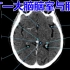 CT—大脑脑室与脑池