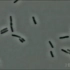 显微镜下青霉素一个一个“戳破”细菌