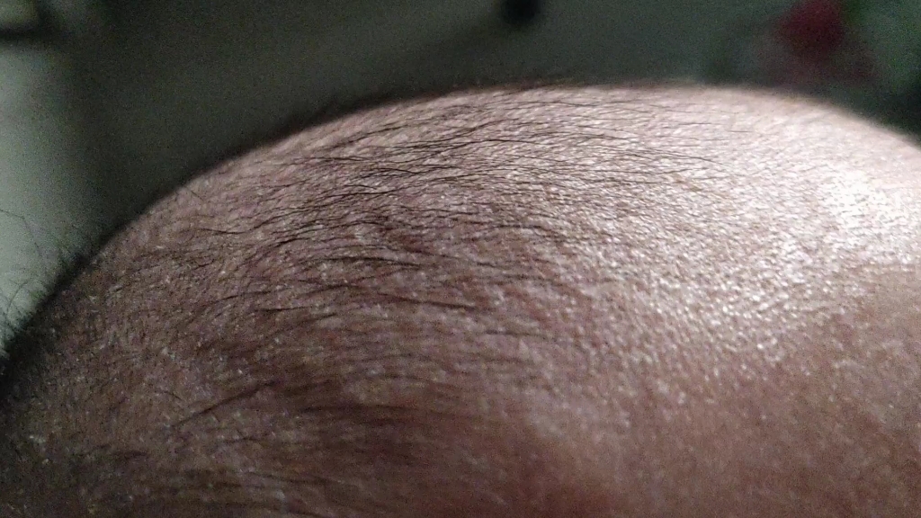 2个月宝宝跳动的囟门