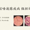 【口组病】口腔唾液腺疾病组织切片(上