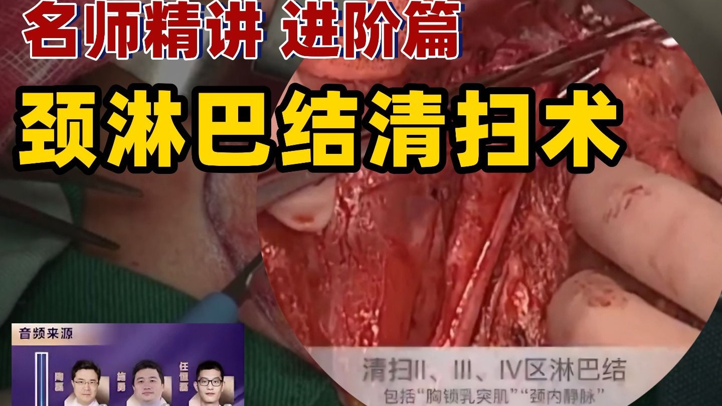 【咽喉头颈进阶篇】根治性颈淋巴结清扫术——耳鼻咽喉手术精讲（进阶篇）