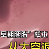 “人类早期胚胎”样本从太空顺利返回 将在山东大学展开后续实验 为人类未来在太空繁衍提供科学依据
