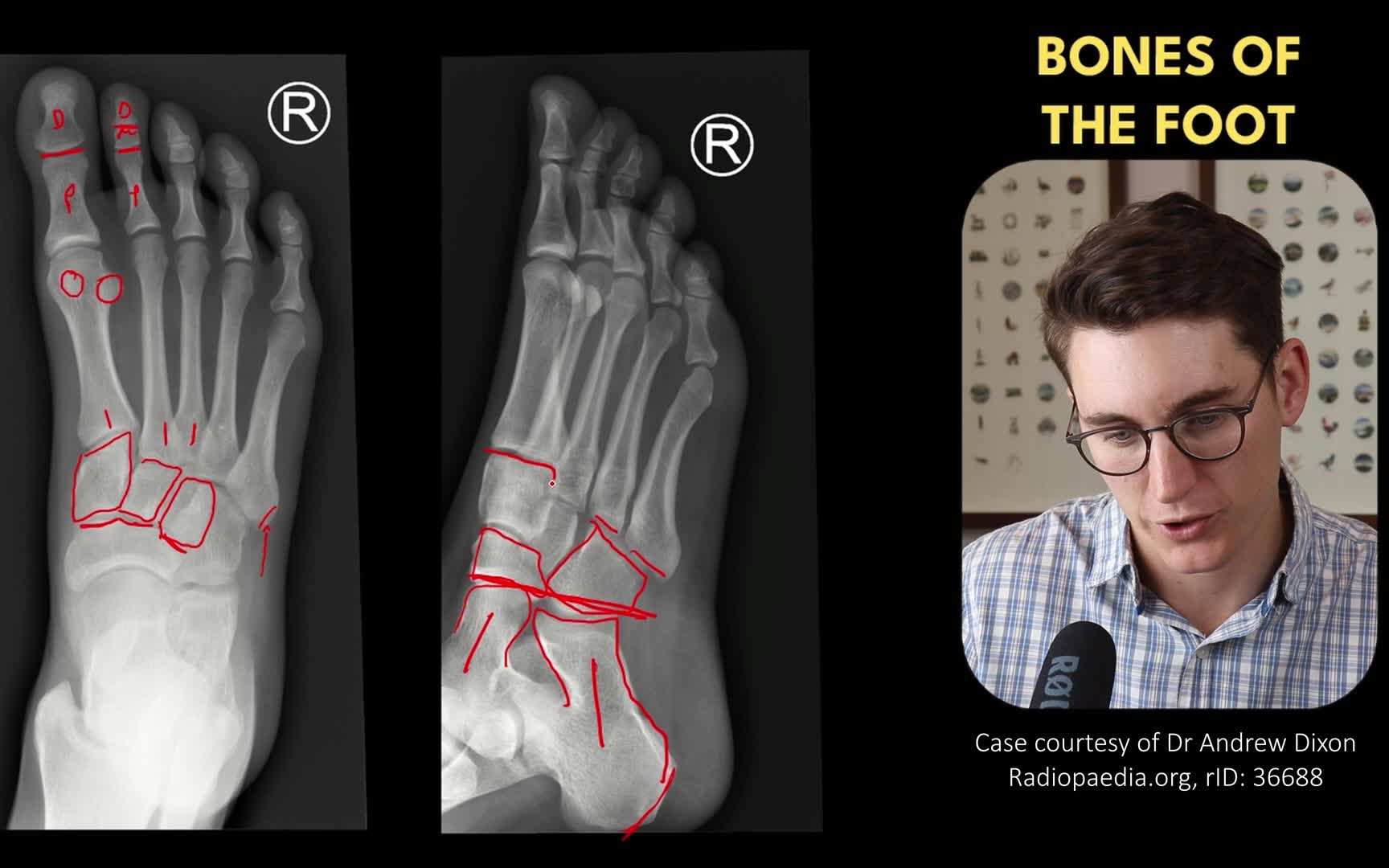 Bones of the Foot and Ankle  Radiology anatomy part 1 prep  Foot and ankle ana哔哩哔哩bilibili