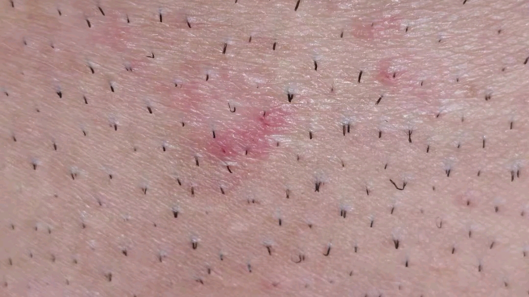 挑战每天得罪一个品牌，今天挑战的是《网红脱毛膏》