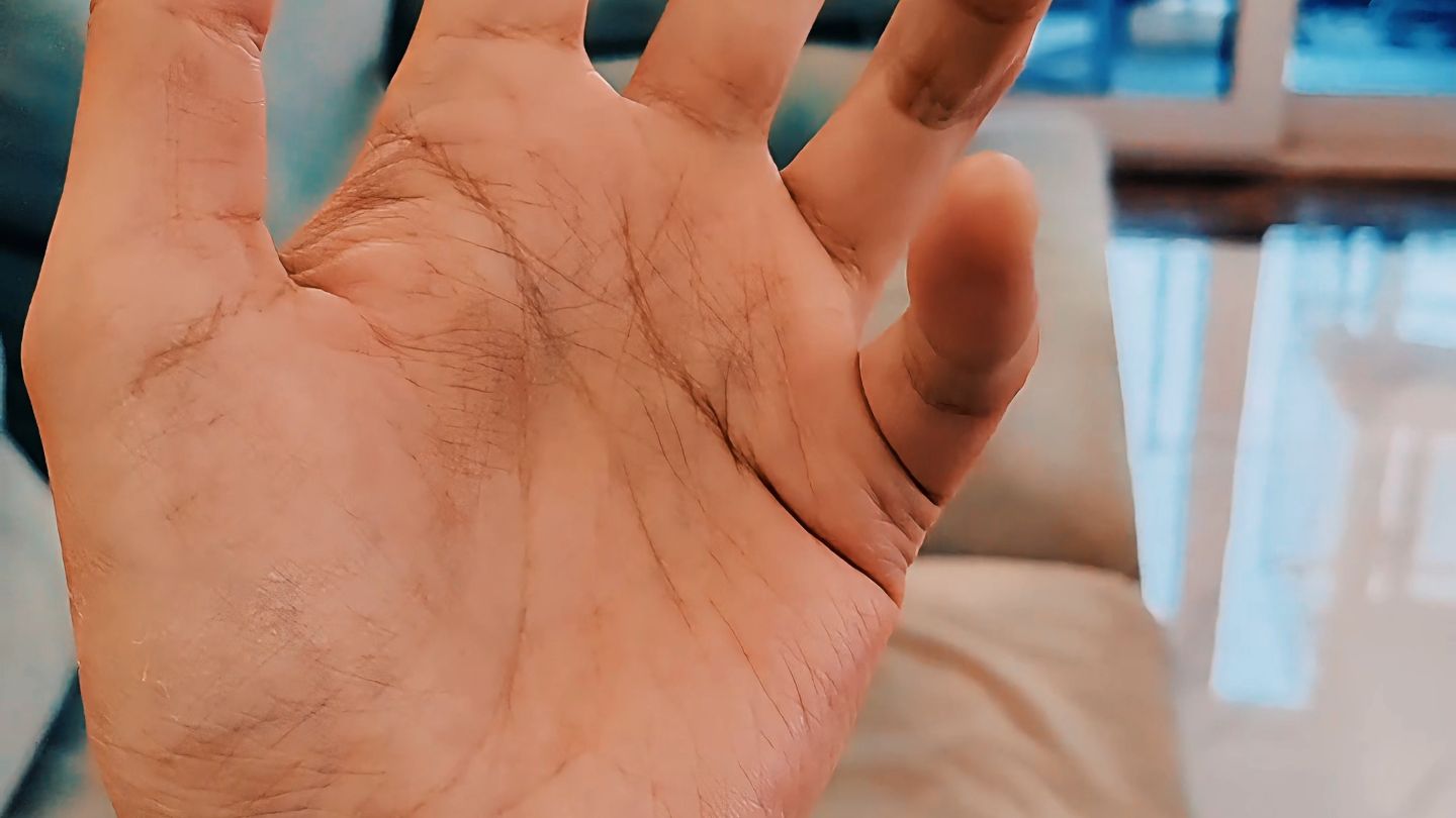 仿妆后终于感受到了，什么叫做源石病的疼痛