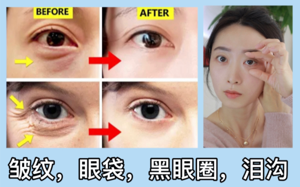6个动作改善眼周老化，皱纹，眼袋，黑眼圈，泪沟说拜拜