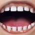 #大连齿医生口腔 孩子的出牙和换牙顺序