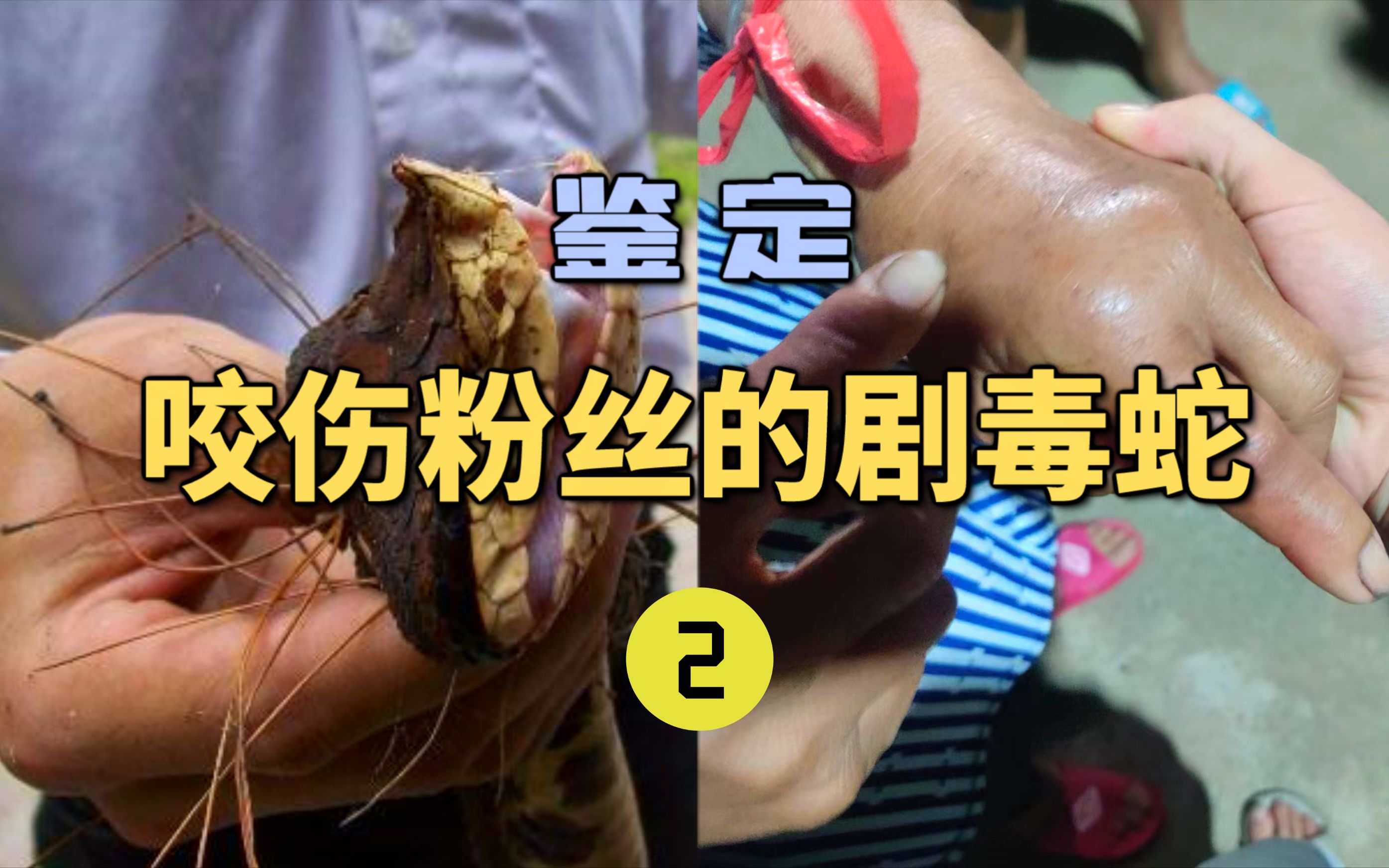 鉴定咬伤粉丝的毒蛇(2)老人自述被五步蛇咬伤！但其实并不是？应该用什么血清？-世界记忆大师龙雅-世界记忆大师龙雅-哔哩哔哩视频