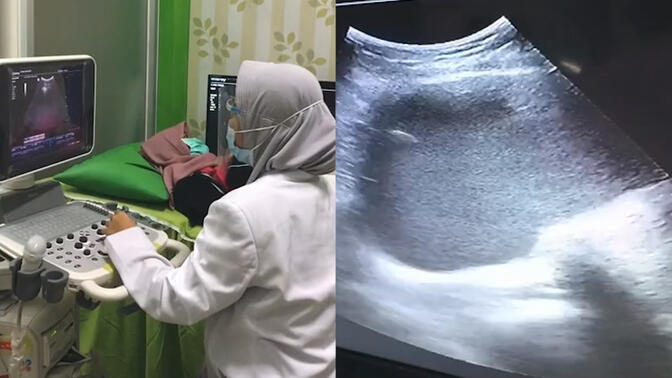女子怀孕9月接受超声波检查，医生却没发现有胎儿，真相令她绝望