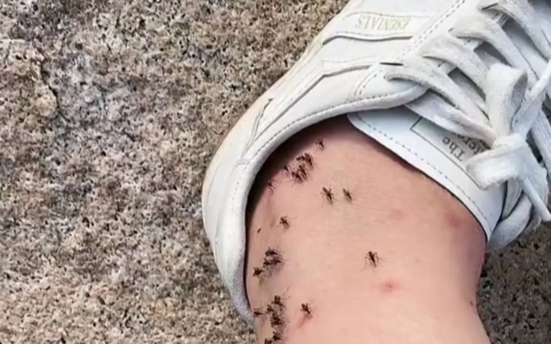 网友腿上布满蚊子，求问一共是多少只，“这真是个狠人”
