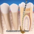 看着就疼系列，牙根管治疗过程，3D演示。。