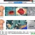 【CAA云讲座】浙江理工大学牛国君博士：腹腔微创手术机器人主从控制研究