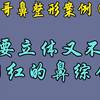 宝哥鼻综合案例（35）既要立体又不要网红的鼻综合