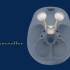 颅咽管瘤（craniopharyngioma）