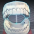 牙齿三维模型