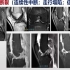 3.膝关节非肿瘤性病变影像诊断-骨肌影像诊断思维系列1