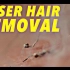 【练听力(⊙o⊙)】【慢镜头·激光脱毛】Science of Laser Hair Removal in SLOW MO