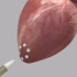 太厉害了，穿刺心脏做换瓣膜手术，3D演示。。