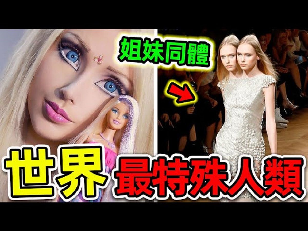 全世界最奇特的10個人類！美女姐妹如何共用身體？第一名堪稱“真人芭比娃娃”，花1000萬整形108次。|#世界之最top #世界之最 #出類拔萃 #腦洞大開 #