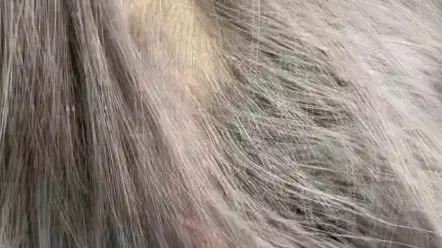 头上有头虱怎么办？#虱子 #虱子卵 #头虱 #头虱子