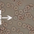 显微镜放大1500倍 观察血液里面的红细胞 白细胞   等高低渗溶液