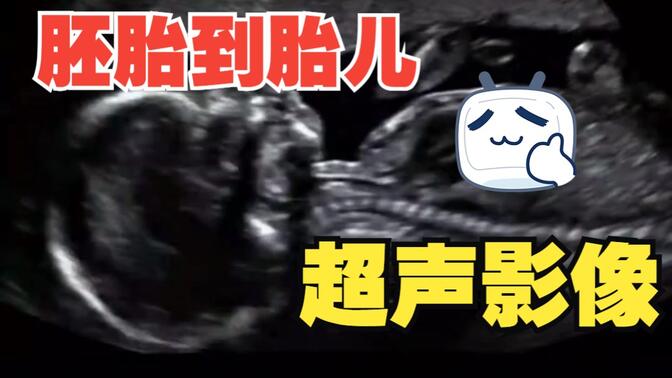 医学超声检查||5-36周胚胎到胎儿的超声影像