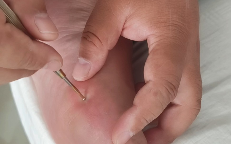 史传秘方，补脾神效