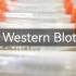【生物研究生】Western Blot实验操作流程 | WB