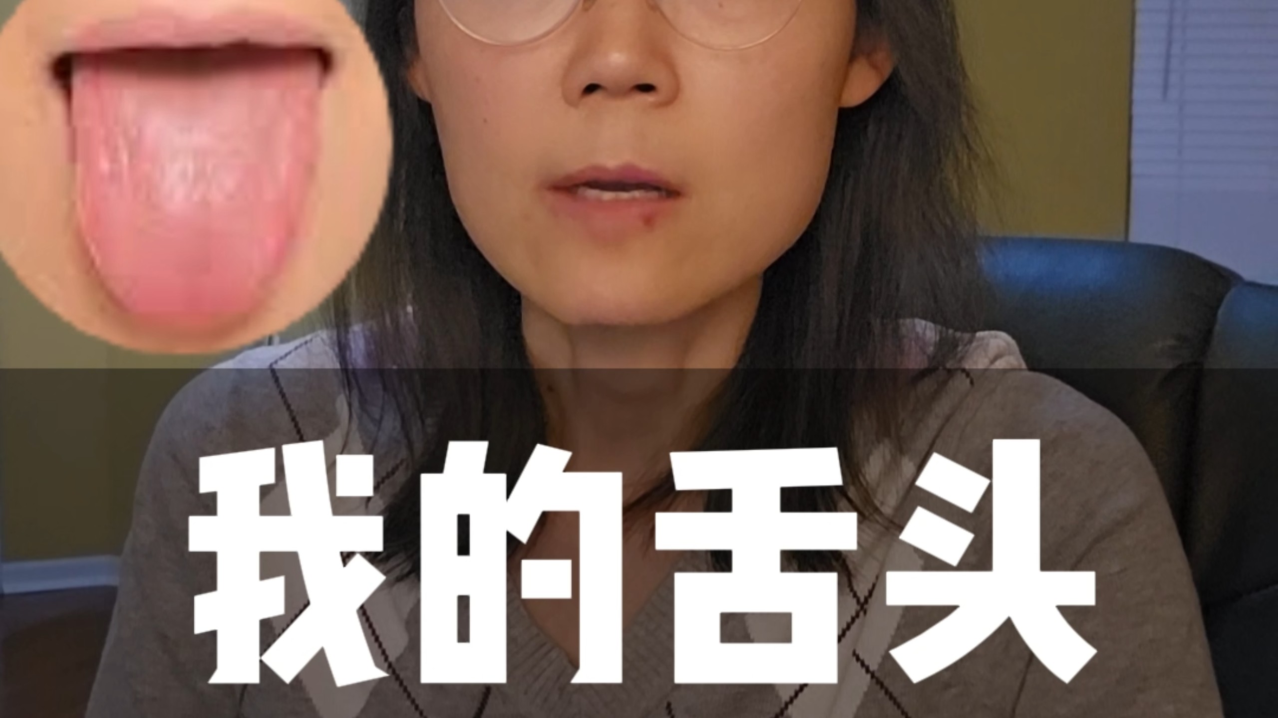 我舌头是瘫痪了？一个湖北人的自白：分清n和l，比高考还难！#教育#说话#湖北#武汉#孝感#方言#自媒体