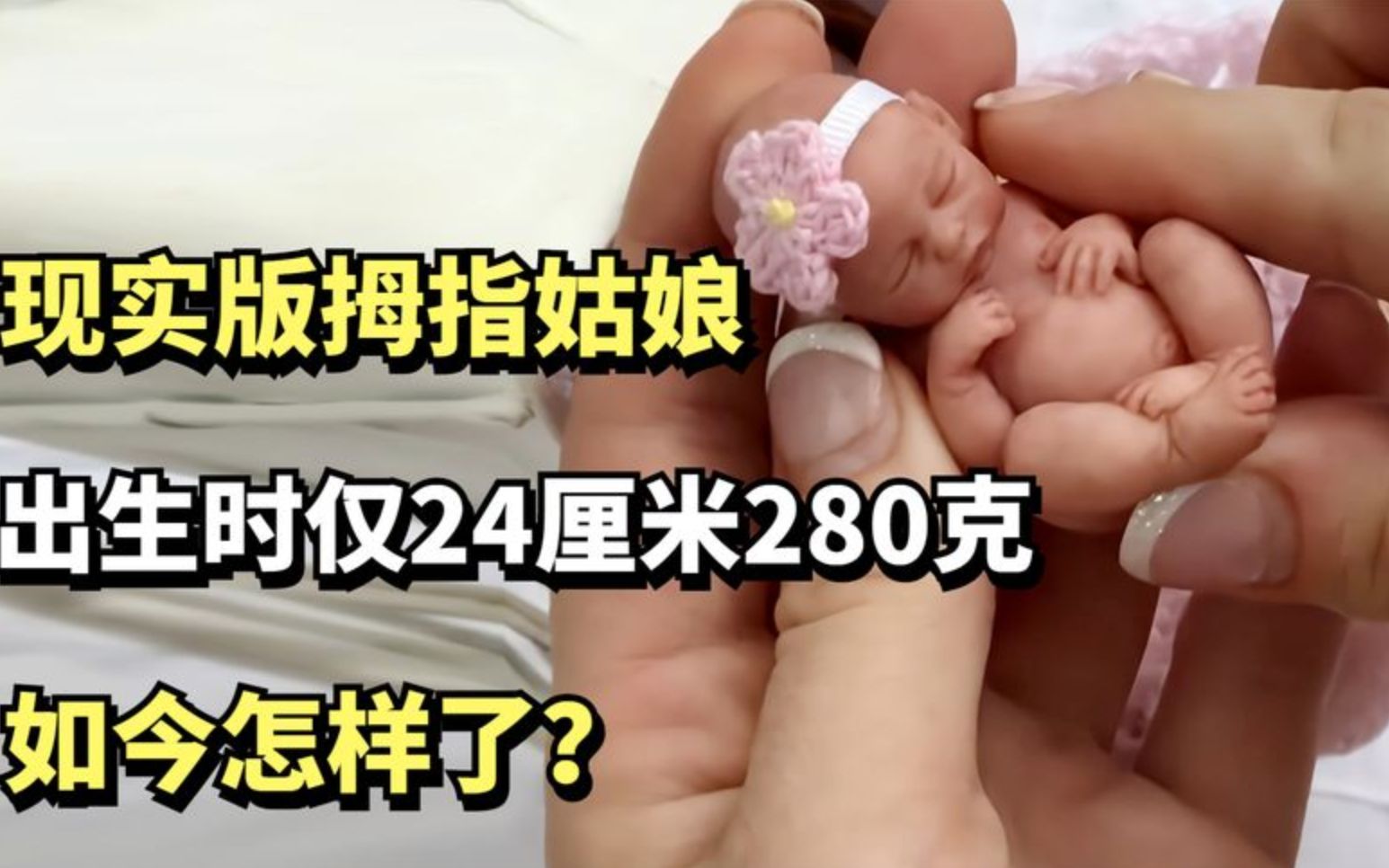 现实版拇指姑娘，出生时仅24厘米280克，如今怎样了？