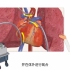 3D动画带您了解心脏室间隔缺损手术的全过程
