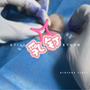 乳钉穿刺过程