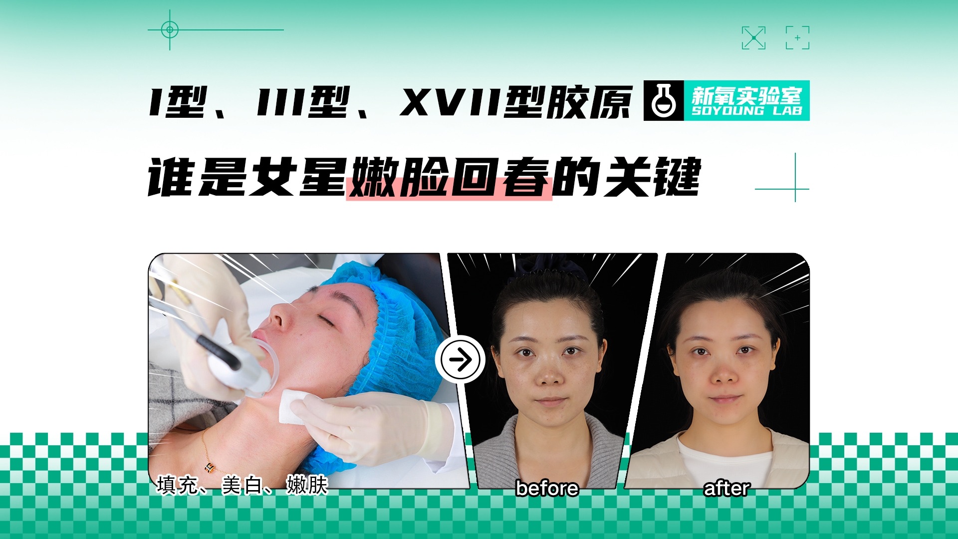史上最全胶原分型大科普|支撑、嫩肤、抓紧皮肉，如何正确找到自己的命定胶原？