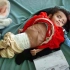 纪录片：也门的贫困儿童，两岁只有4公斤，37万儿童饥饿成病