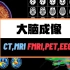 科普 | 大脑成像101 CT/MRI/FRMI/PET/EEG的原理