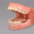两颗大牙缺失太久怎么办？还有救吗？