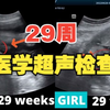 医学超声检查||男宝宝vs女宝宝||29周