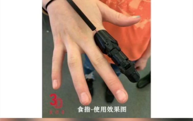 3D假指，适合手指还剩一节者，佩戴后可以做一些事情，还可以多个搭配使用。#假指 #断指 #假肢 #残疾
