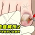 脚指头甲沟炎严重，指甲变形导致内部溃烂发炎，修剪过程超解压