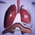 肺破了如何把气体排出来，胸腔闭式引流术原理，3D演示。。