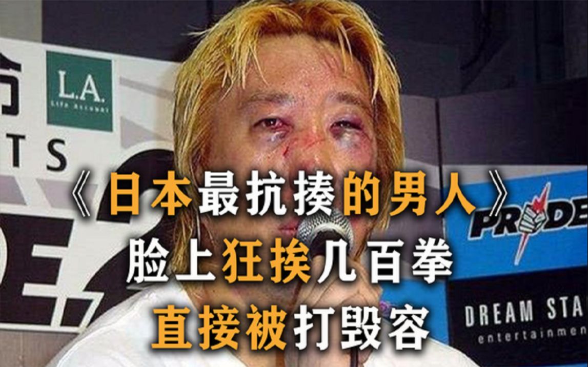 日本最抗揍的男人，一场拳击脸上挨了几百拳，直接被打毁容