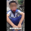 12岁男童遭家长打成香肠嘴  镇派出所：教育过当 但孩子有偷钱行为