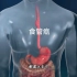 这大夫也太有创意了，食管癌手术过程，3D演示。。